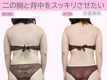 ぷるるんエステ/痩身/ダイエット/筋膜リリース