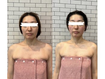 アリュール(ALLURE)/巡りフェイシャル