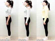 モア 札幌平岸店(MORE)/足を細くしたい