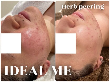 イデアルミー 大宮店(イデアルMe)の写真