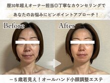 メイヴィ 四日市(Maivi)の雰囲気(1回でも変化を実感◎続けていただくとさらに理想の小顔に♪)