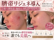 ミラヴィエ(Miravie)
