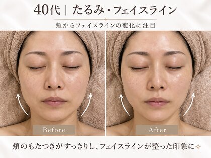 ミニョンボーテ(mignon beaute)の写真