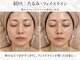 ミニョンボーテ(mignon beaute)の写真