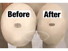 美極 トータルビューティー(美極 TOTAL BEAUTY)/恵比寿/小顔コルギ/エステ/