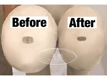 美極 トータルビューティー(美極 TOTAL BEAUTY)/恵比寿/小顔コルギ/エステ/