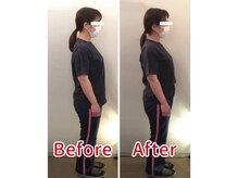 ほぐし屋さん/猫背の姿勢が一回でここまで変化