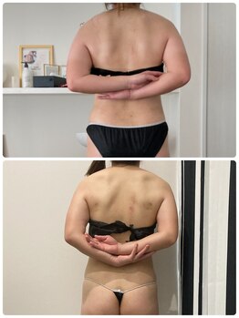 フフレ(fufre)/全身痩身120分コース