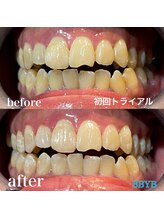 ビーバイビー(BBYB)/初回トライアル実例♪
