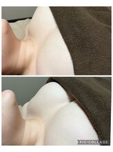 アップオー 小倉店(up・O)/体験者様　施術例