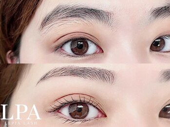 レピア 高槻店/韓国式LEPIA Before&After