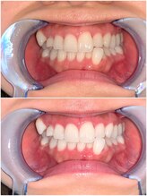 ライトビューティー 池袋店(LightBeauty)/症例写真