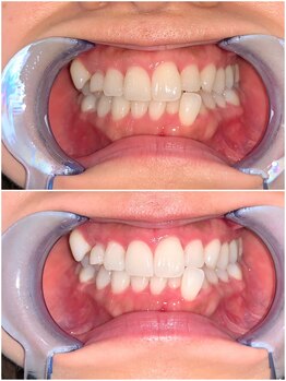 ライトビューティー 池袋店(LightBeauty)/症例写真