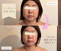 チャム(cham)