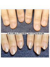 マニエネイル(mani e nail)/深爪矯正/自爪育成/ネイルケア