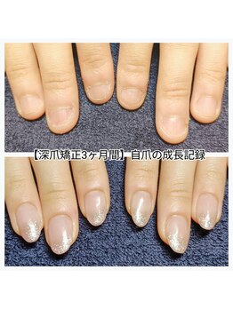 マニエネイル(mani e nail)/深爪矯正/自爪育成/ネイルケア