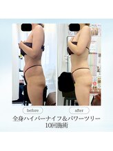 エスプレッソ(espresso,)/【全身痩身10回】下腹スッキリ♪