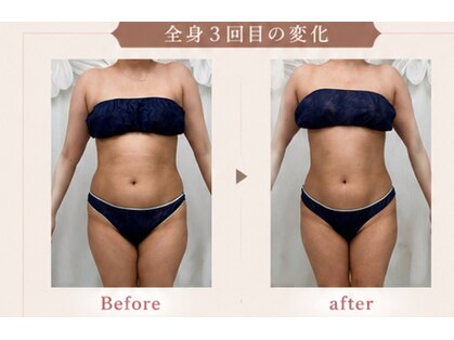 ステラ(Stella)の写真