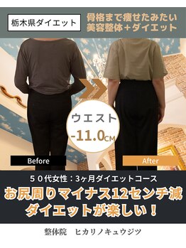 整体院ヒカリノキュウジツ さくら店の写真/【的確な施術】歪み調整/運動療法など…様々な施術を精度高くご提供!原因を見過ごさず解決策をご提示◎