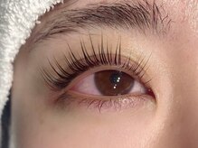 アイクイック 新宿 新宿駅西口店(Ai Quick)/ラッシュアディクト3ヶ月使用後