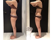 リボディ 表参道(An re Body)/before→after