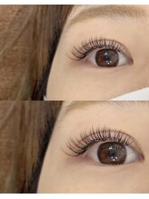 トータルビューティーローズ(Rose)/まつエクデザイン☆