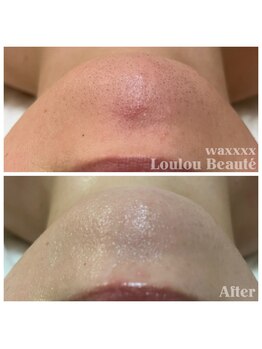 ルルボーテ(Loulou Beaute)/waxxxx