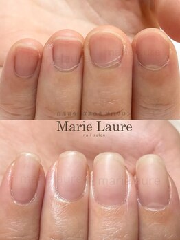 マリーロール 淀屋橋本店(Marie Laure)/自爪育成/深爪矯正/ネイルケア