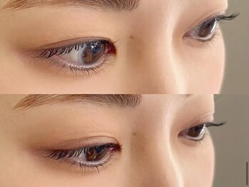 マイサロン 本通り(MY SALON)/まつげパーマ/ラッシュリフト