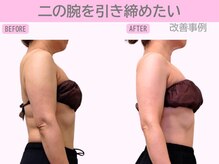 ぷるるんエステ/痩身/ダイエット/整体