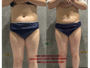 リボーン(REBORN)/美容ダイエット