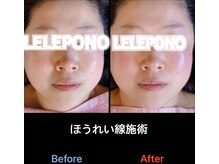 美容矯正サロン レレポノ(LELEPONO)/