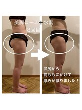 ヨサパーク アミカル 八幡山店(YOSAPARK amical)/水素コース8回目 &nbsp;before→after