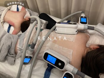 レナータ 渋谷店(RENATA)の写真/【最先端の脂肪冷却機多数完備!!】脂肪冷却/小顔冷却/韓国腸活デトックスハーブで美ボディメイク