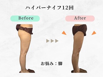 美容整体 ウェリナ 蟹江院/小顔矯正/骨盤矯正/痩身整体