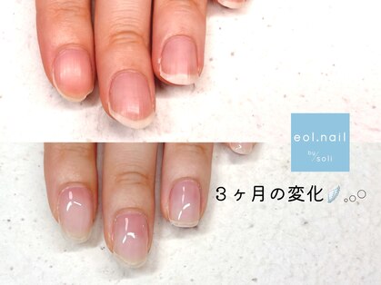 エオル(eol.)の写真