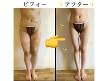 ミナミナ(MINA MINA)の雰囲気（キャビテーションで美脚に◎ダイエット・痩身お任せください！）