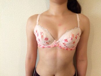 ジュエルリング(Jewel Ring)/大学生のモニター樣 after