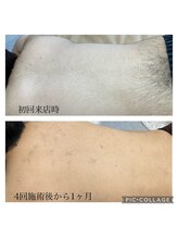 グラース(grace)/