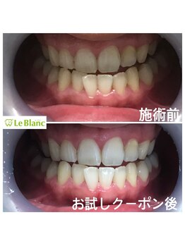 ルブラン 奈良店(Le Blanc)/思い立ったら是非!!