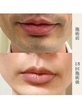 ダリアビューティー(Dahlia Beauty)/Before After画像