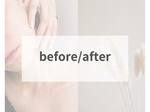 エステ ド あーと/before/after