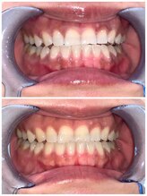 ライトビューティー 池袋店(LightBeauty)/症例写真