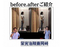 栄光治院 整体院東岡崎/たったの10分で綺麗になる！