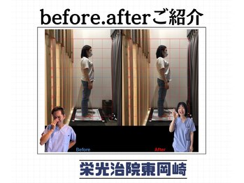 栄光治院 整体院東岡崎/たったの10分で綺麗になる！