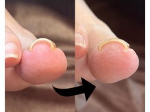フットタイムズ(FOOT TIMES)の雰囲気（痛みのない巻き爪ケアをお探しならぜひ一度ご相談ください．）