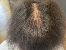 リノ(Lino)/ヘアーアディクト