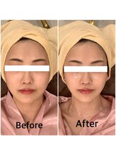 スペチアーレ 夙川/小顔と美肌の美顔革命