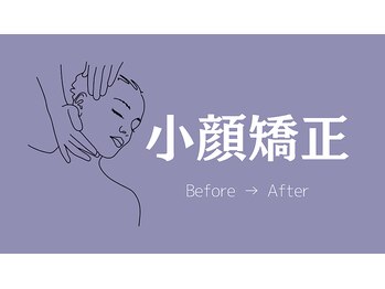 ココ(COCO.)/小顔整顔矯正　Before→After 集