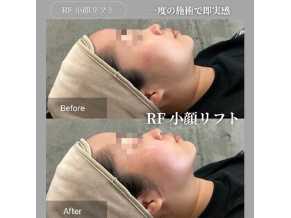 ハッチ(HATCH)の写真
